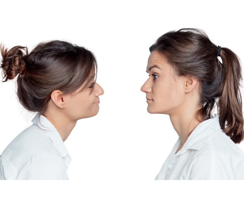 How Can We Enhance the Nose Tip Surgery Recovery Process?