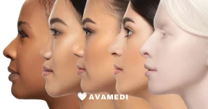 Different types of noses for rhinoplasty surgery